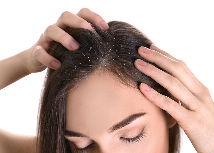 Scalp Peeling Treatment in Delhi
